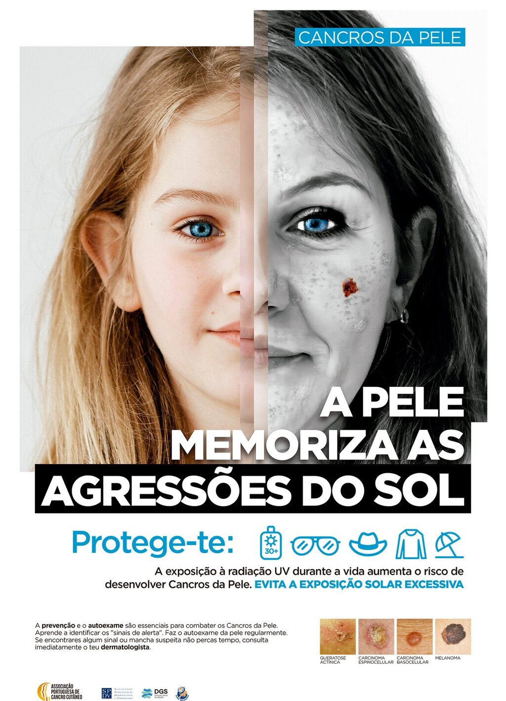  CAMPANHA "PELE E SOL 2025" - ASSOCIAÇÃO PORTUGUESA DE CANCRO CUTÂNEO